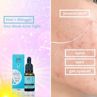 Aish Serum Acne Serum Original BPOM