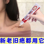 Keloid Scar Reduce Scars Cream Scar Hot Sale Scar Gel Removal Repair Removal Scald Scar Removal Crea