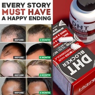 Biotin DHT Blocker Hair Growth Capsules Prevents Hair Fall Stimulates Follicles Natural Supplement F