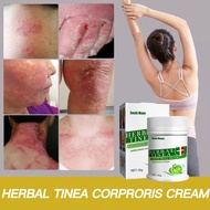 Psoriasis Eksim Salep Gatal / Psoriasis Ointment Psoriasis Eczema Cream Psoriasis Treatment Cream fo