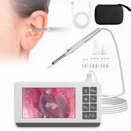 Otoscope Digital Camera 3.9Mm 4.3 Inch HD 1080P Ear Cleaning For Kids And Adults Type-C With 32G