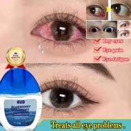 Eye Drops for Clear Vision Dry Eyes Red Eye Suitable for cold application eyesight fatigue,itchy eye