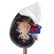PVC Natural Life Size Human Kidney with Adrenal Gland Anatomical Medical Model