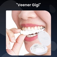 Venner White Perapih Gigi / Snap on Smile Veneers Gigi Perfect