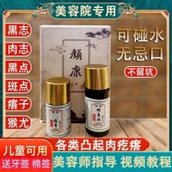 去痣点痣膏无痕正品非药水脸部祛斑淡斑神器点斑水去痣笔专用膏液Mole Removing Point Mole Cream No Trace Genuine Non Liquid Facial Trea