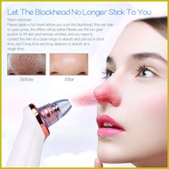 ❈ ◬ ☽ 【Local Delivery】 CkeyiN pimple remover Vacuum Blackhead Remover whiteheads remover tool with