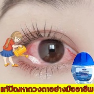 BLUEBERRY EYE DROPS 15mL เพิ่มความชุ่มชื่นดวงตา ชนิดขวด รายเดือน Exp.2026 แสบตา แพ้แสง ไวต่อแสง ตาพร่า