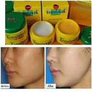 TEMULAWAK CREAM 100% ORIGINAL (1 SET DAY AND NIGHT CREAM)