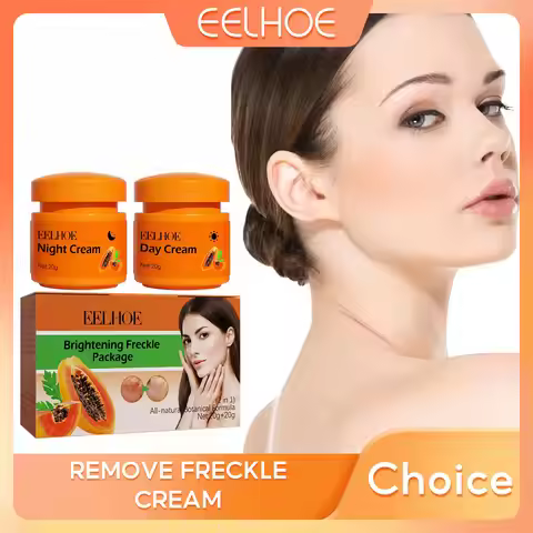 Whitening Freckle Cream Melanin Blemish Remover Lighten Pigmentation Melasma Removal Whiten Nourish 