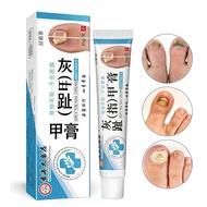Hong Kong Pharmacy Onychomycosis Nail Cream Antibacterial Cream Nail Thick Cream Foot Care Onychomyc