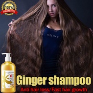 Ginger shampoo 500ML Anti hair loss/Fast hair growth/Anti dandruff/Control oil/Relieve itching/Moisturizing Suitable for men, women, old and young