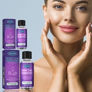 EELHOE Wart Removal Serum Skin Tag Remover Mole Remover Essence Corn Plaster Antibacterial Foot Wart