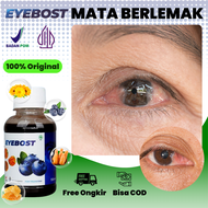Obat Penghilang Lemak Mata Herbal Mata Berlemak Berselaput Berlamad Pterigium Pterygium - Eyebost Or
