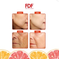 Sweet Nicely Fdf Skincare Travel Set With Free Product Sample