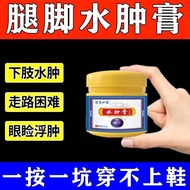 Low Limb Edema Edema Cream Small Leg Foot Edema Elderly Edema Whole Body Edema Face Edema Wear Shoes