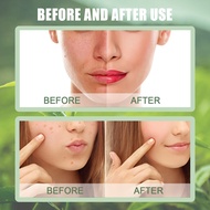 OUHOE green tea mask stick acne blackhead acne facial deep cleansing tight pores smear type mask mud