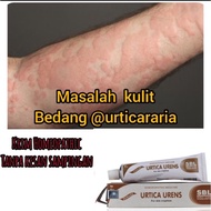 URTICARIA rawatan H0me0pathy Remedy.