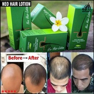 Neo Hair Lotion Anti-Hair Loss Tonic Hair Treatment Solution 120ml