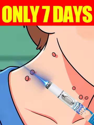 blue light pen to solve neck warts, axillary wart care tools