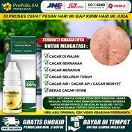 Obat Untuk Cacar Air Herbal Cacar Air Bernanah Cacar Air Di Punggung Cacar Di Wajah Cacar Di Dada Ca