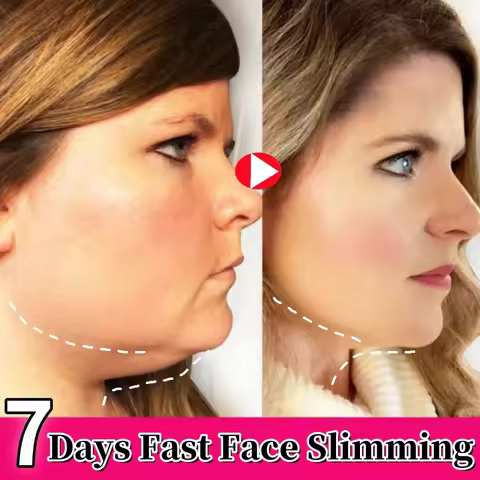 V-Shape Face Slimming Cream Remove Double Chin Firm Lift To Create A Small V Face Fat Burning Anti-a