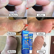 脚气王抑菌膏 ubat kulat kaki ubat kaki Kaki mengelupas Kulat air Kaki gatal berbau Foot fungus Sumifun ber