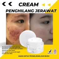 Effective Permanent acne Cream acne Scar Cream acne Remover acne scar remover acne scar removal crea