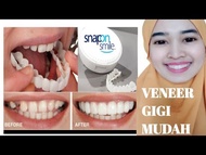 Snap On Smile Venner Gigi 100% Original Gigi Palsu 1 Set Atas Bawah