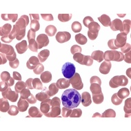 Leishman's eosin methylene blue solution modified for microscopy