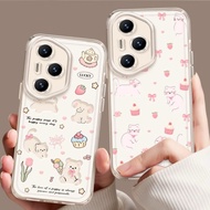 W² Lab Honor 400/400 Pro/400 Lite/300/300 Ultra/300 Pro Case Sarung Telefon Lembut可爱荣耀Honor保护手机壳壳