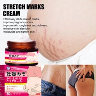 Stretch Mark Cream Herbal stretch mark cream Permanent Stretch Mark Remover Cream Effectively fades 