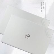 Laptop Skin Sticker Decal 14 Inch Personalized Universal Notebook Vinyl Cover Art Protector Decal fo