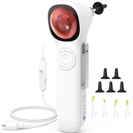 SA160 Digital Otoscope IPS HD Screen Smart Video Otoscope with Light, Ear Camera Earwax Removal Came