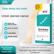Scar Breathable Patch C-Section Sterile Silicone Scar Repair Patch
