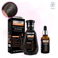 【Rdy Stock现货】Original Hair Growth Essence Anti Hair Loss Shampoo Serum Preventing Hair Loss Damage R