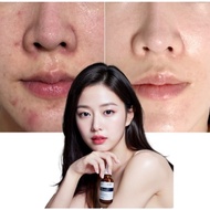 Muama Retinol Heartleaf Ampoule 30ml – Acne Scar Repair & Sebum Control Serum / Houttuynia + Hyaluro