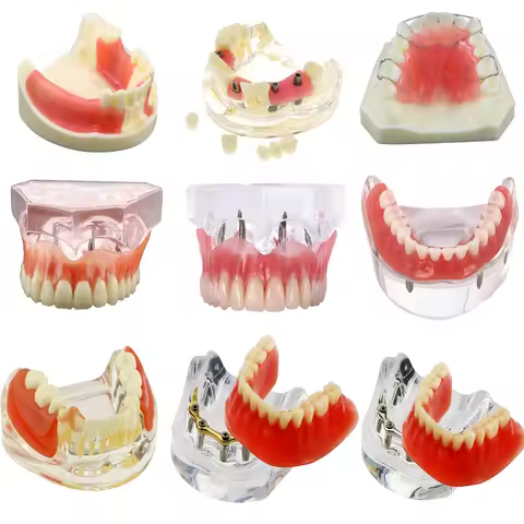 Teeth Implant Model Dental 2/4 Implant Overdenture Restoration Upper Lower Teeth Model Typodont Impl