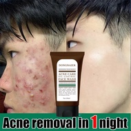 Amino acid cleanser100ml Deep Cleansing Whitening oil Control Acne Treatment Repair Barrier Acne Tre