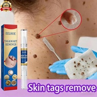 Skin vegetation remover, wart remover pen, mole remover, removal of moles and warts, cholesterol see