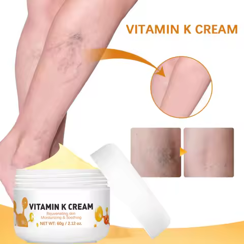 NEW Vitamin K Cream Varicose Vein Relief Cream Massage Care Relieve Leg Soreness Swelling Phlebitis 