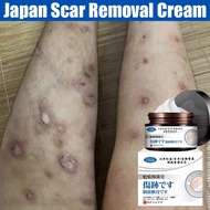 krim hilangkan parut hitam Scar Removal Cream Hilangkan parut kaki Menghilangkan bekas luka lama Hil