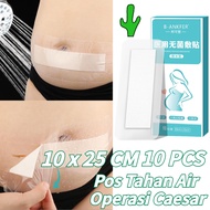 CESAR 10PCS 10 x 25 CM Caesarean Section Caesarean Wound Plaster Post-Cesarean Section Plaster White