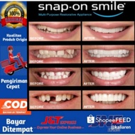 Snap On Smile 100 ORIGINAL Authentic Snap On Smile Gigi Palsu