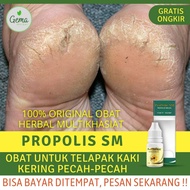 Obat buat Kaki Pecah dan Kering - Obat Tumit Kaki Pecah Pecah Obat Nyeri Telapak Kaki Obat Kulit Tel