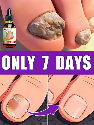 Reduce your worries and stop fretting about your nails.