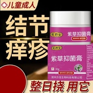 Knots Itchy Skin Itchy Itchy Itchy Itchy Itchy Red Swelling Itchy Cream Children Adults Universal Sk