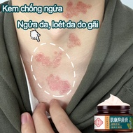 Anti-itch Cream Anti-Fungal Anti-Itch Cream Anti-Itch Vaginal Cream Body Itching Cream Removes Fungal Skin Healing Acne