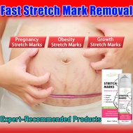 Local seller ✨ Stretch mark cream, stretch mark correction cream, stretch mark removal, obesity mark