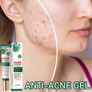 ubat jerawat acne spot treatment tea tree pimple cream hilangkan parut jerawat ubat jerawat muka ant