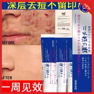 Apan Lion Pair Acne Cream 24g Antibacterial Acne Face Cream 24g Pimple Anti Acne Pimples 祛痘膏 痘痘膏 淡痘印